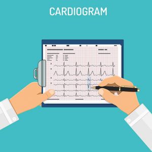 Cardiogram on clipboard in hands of doctor